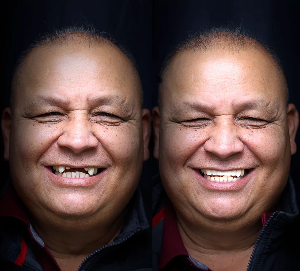 bridges-before-after (2)