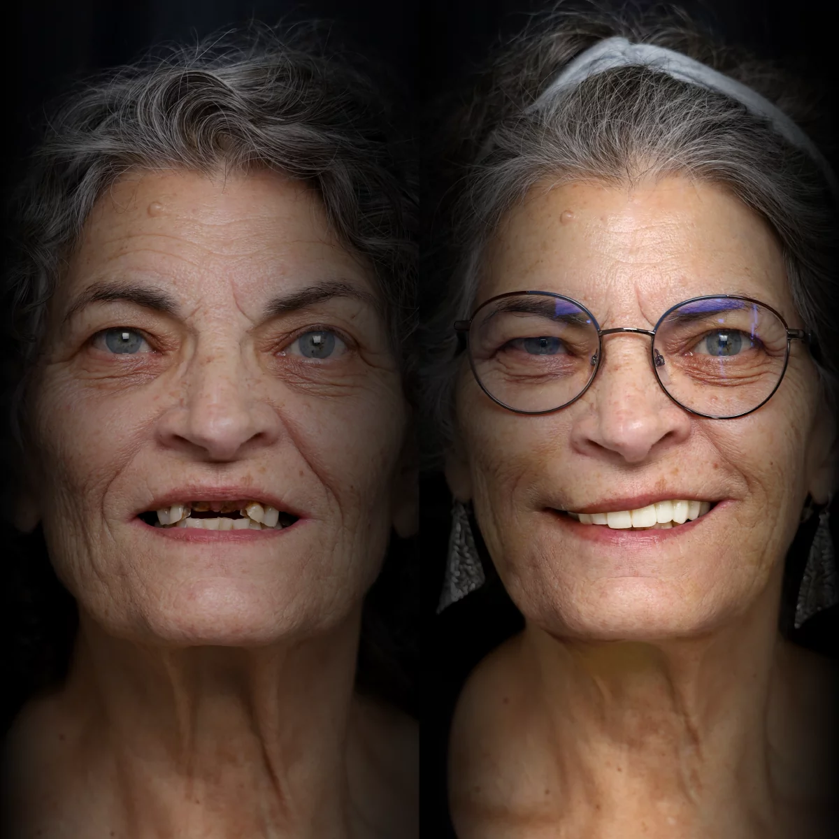 bridges-before-after (3)