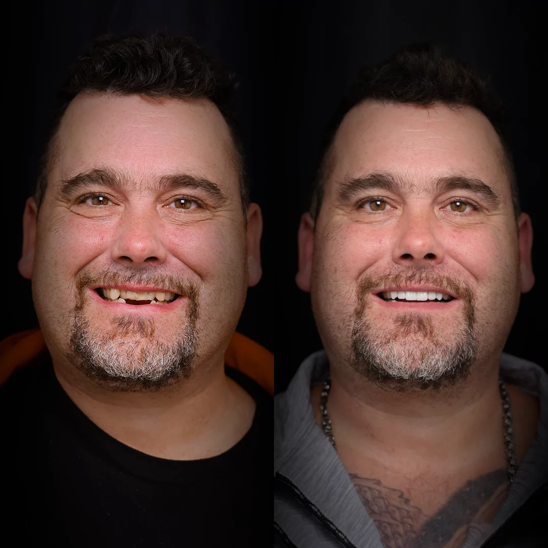 bridges-before-after (4)