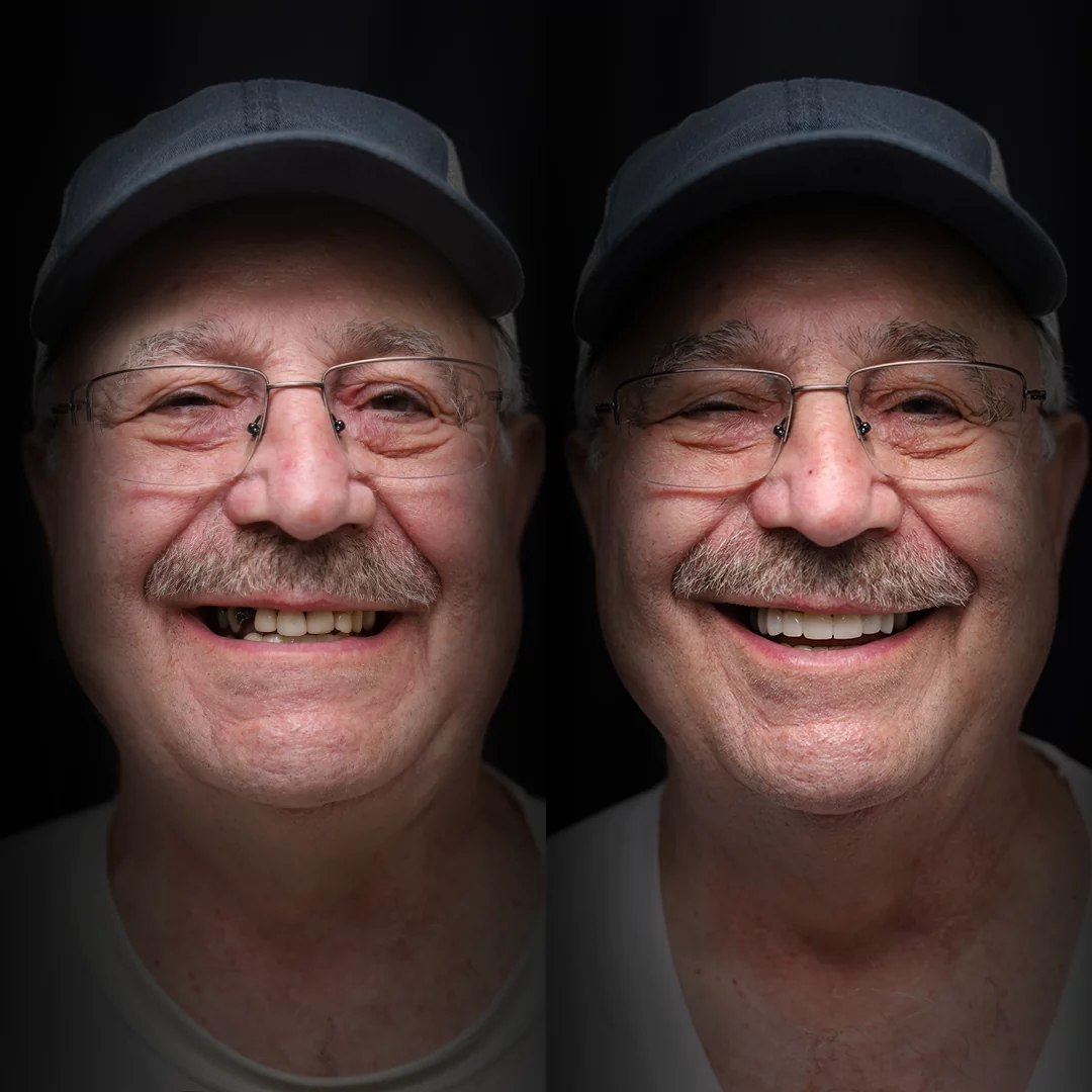 bridges-before-after (5)